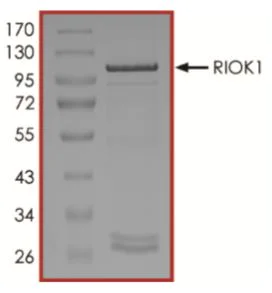 SDS-PAGE - Recombinant Human RIOK1/RIO1 protein (Tagged) (AB268939)