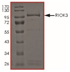 SDS-PAGE - Recombinant Human RIOK3 protein (Tagged) (AB268941)