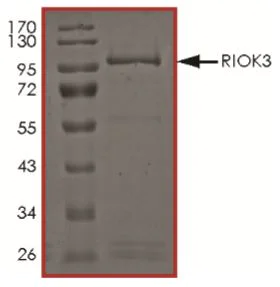 SDS-PAGE - Recombinant Human RIOK3 protein (Tagged) (AB268941)