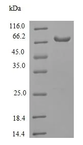 SDS-PAGE - Recombinant Human RIP3 protein (Tagged) (AB240851)