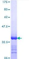SDS-PAGE - Recombinant Human RNA Helicase A protein (AB114300)