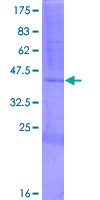 Recombinant Human RNase 7 protein