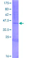 SDS-PAGE - Recombinant Human RNase 7 protein (GST tag N-Terminus) (AB164629)