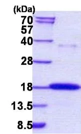 SDS-PAGE - Recombinant Human RNase 7 protein (His tag N-Terminus) (AB156731)