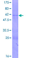 Recombinant Human RNase H1/RNH1 protein