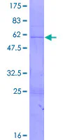 SDS-PAGE - Recombinant Human RNase H1/RNH1 protein (GST tag N-Terminus) (AB153634)