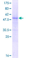 SDS-PAGE - Recombinant Human RNF115 protein (GST tag N-Terminus) (AB162124)