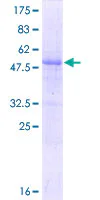 SDS-PAGE - Recombinant Human RNF115 protein (GST tag N-Terminus) (AB162124)