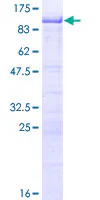 SDS-PAGE - Recombinant Human RNF168 protein (GST tag N-Terminus) (AB153613)