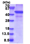 SDS-PAGE - Recombinant Human RNF34 protein (His tag N-Terminus) (AB176063)