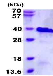 SDS-PAGE - Recombinant Human RNF4 protein (His tag N-Terminus) (AB134611)