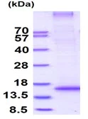 SDS-PAGE - Recombinant Human RNF7 protein (denatured) (His tag N-Terminus) (AB171587)