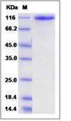 SDS-PAGE - Recombinant Human Robo2 protein (His tag) (AB276243)