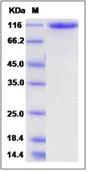 SDS-PAGE - Recombinant Human Robo2 protein (His tag) (AB276243)