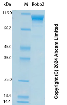 SDS-PAGE - Recombinant Human Robo2 Protein Standard (His tag) (AB323131)