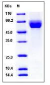 SDS-PAGE - Recombinant Human Robo4 protein (His tag) (AB276447)