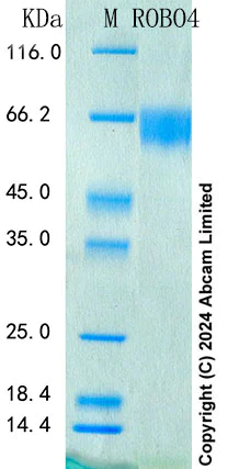 SDS-PAGE - Recombinant Human ROBO4 Protein Standard (His tag) (AB316655)