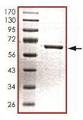 SDS-PAGE - Recombinant human ROCK2 protein (AB125828), expandable thumbnail