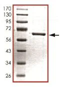 SDS-PAGE - Recombinant human ROCK2 protein (AB125828)