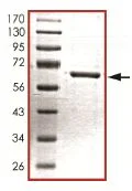 SDS-PAGE - Recombinant human ROCK2 protein (His tag N-Terminus) (AB125828)