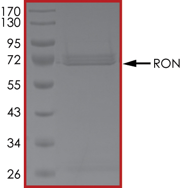 SDS-PAGE - Recombinant human RON protein (AB70541), expandable thumbnail