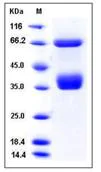 SDS-PAGE - Recombinant Human RON protein (His tag) (AB276409)