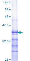 SDS-PAGE - Recombinant Human ROR alpha/RORA protein (AB159367), expandable thumbnail