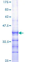 SDS-PAGE - Recombinant Human ROR alpha/RORA protein (GST tag N-Terminus) (AB159367)