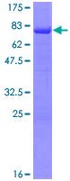 Recombinant Human ROR beta/RORB protein
