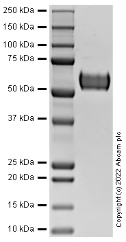 SDS-PAGE - Recombinant Human ROR1 Protein (AB290054)