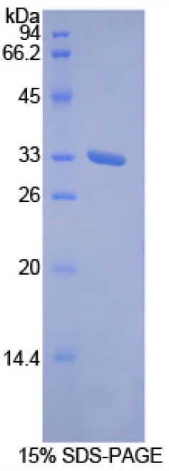 SDS-PAGE - Recombinant human ROR1 protein (Tagged) (AB270600)