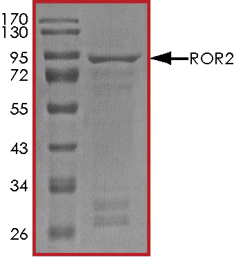 SDS-PAGE - Recombinant human ROR2 protein (AB70614)
