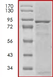 SDS-PAGE - Recombinant human ROR2 protein (AB70614)