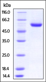 SDS-PAGE - Recombinant Human ROR2 protein (His tag) (AB221029), expandable thumbnail