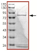 SDS-PAGE - Recombinant human ROS1 protein (AB125624), expandable thumbnail