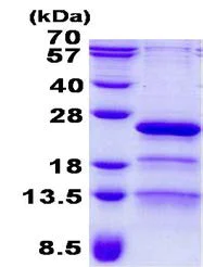 SDS-PAGE - Recombinant Human RP9 protein (His tag N-Terminus) (AB139200)