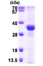 SDS-PAGE - Recombinant Human RPA32/RPA2 protein (AB101216)