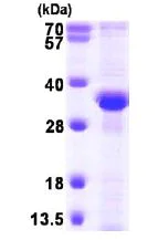 SDS-PAGE - Recombinant Human RPA32/RPA2 protein (His tag N-Terminus) (AB101216)