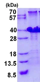 SDS-PAGE - Recombinant Human RPC8 protein (His tag N-Terminus) (AB134603)