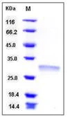 SDS-PAGE - Recombinant Human RPE protein (His tag) (AB276449)
