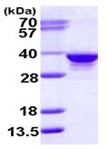 SDS-PAGE - Recombinant Human RPIA/PRI protein (AB116207), expandable thumbnail