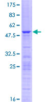 SDS-PAGE - Recombinant Human RPL10A protein (GST tag N-Terminus) (AB152563)