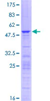 SDS-PAGE - Recombinant Human RPL10A protein (GST tag N-Terminus) (AB152563)