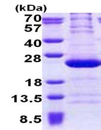 SDS-PAGE - Recombinant Human RPL11 protein (AB167891)