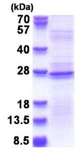 SDS-PAGE - Recombinant Human RPL18A protein (denatured) (AB180319), expandable thumbnail