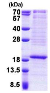 SDS-PAGE - Recombinant Human RPL22 protein (AB167872)