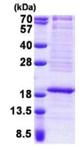 SDS-PAGE - Recombinant Human RPL22 protein (AB167872)