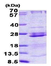 SDS-PAGE - Recombinant Human RPL23A protein (AB156337)