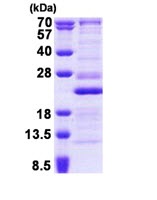 SDS-PAGE - Recombinant Human RPL26 protein (His tag N-Terminus) (AB167904)