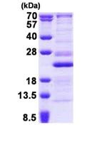 SDS-PAGE - Recombinant Human RPL26 protein (His tag N-Terminus) (AB167904)